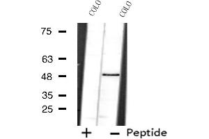 Western blot analysis of extracts from COLO cells using PRPF19 antibody. (PRP19 antibody  (N-Term))