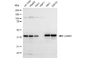 Western blotting analysis using CAMK1 antibody (ABIN7797830).