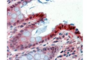 ABIN185316 (2. (HPGD antibody  (C-Term))