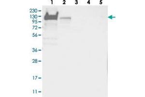 Western blot analysis of Lane 1: RT-4, Lane 2: U-251 MG, Lane 3: Human Plasma, Lane 4: Liver, Lane 5: Tonsil with YTHDC1 polyclonal antibody  at 1:250-1:500 dilution.