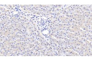 Detection of CRP in Bovine Liver Tissue using Polyclonal Antibody to C Reactive Protein (CRP) (CRP antibody  (AA 14-224))