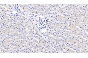 Detection of CRP in Bovine Liver Tissue using Polyclonal Antibody to C Reactive Protein (CRP)