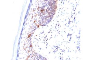 Formalin-fixed, paraffin-embedded human Skin stained with CD1a Mouse Monoclonal Antibody (C1A/711). (CD1a antibody)