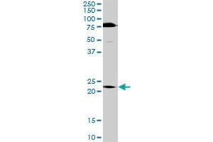 TRIM55 MaxPab rabbit polyclonal antibody. (TRIM55 antibody  (AA 1-452))
