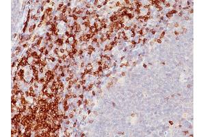 Formalin-fixed, paraffin-embedded human Tonsil stained with CD5 Monoclonal Antibody (SPM546) (CD5 antibody)