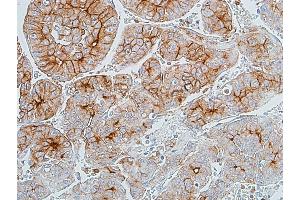 Immunohistochemistry (IHC) image for anti-Carcinoembryonic Antigen-Related Cell Adhesion Molecule 1 (CEACAM1) (AA 35-433) antibody (ABIN7455148)
