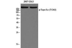 Western Blot (WB) analysis of 293T COLO205 using p-Topo IIalpha (T1343) antibody. (Topo IIalpha (pThr1343) antibody)