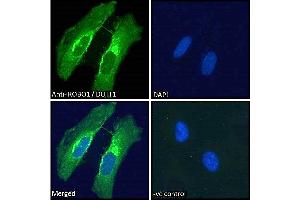 ABIN185537 Immunofluorescence analysis of paraformaldehyde fixed HeLa cells, permeabilized with 0. (ROBO1 antibody  (Internal Region))