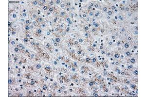 Image no. 2 for anti-Checkpoint Kinase 2 (CHEK2) antibody (ABIN1497497) (CHEK2 antibody)