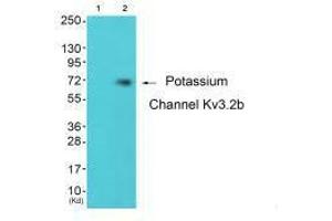 Western blot analysis of extracts from 293 cells (Lane 2), using Potassium Channel Kv3. (KCNC2 antibody)