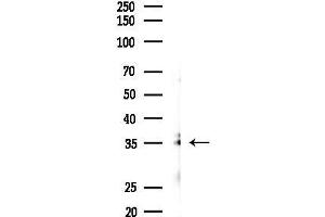 Western blot analysis of lysates from K562 cells(UV 30 min treatment), using IL-2RA/C Antibody at 1/1000 dilution.