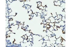 IHC analysis of RAGE/AGER using anti-RAGE/AGER antibody (ABIN7601722). (RAGE antibody  (AA 43-404))