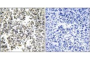 Immunohistochemistry analysis of paraffin-embedded human lymph node, using IGLL1 Antibody. (IGLL1 antibody  (AA 161-210))