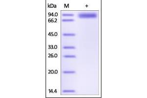 Human ROR1, Fc Tag on SDS-PAGE under reducing (R) condition. (ROR1 Protein (AA 30-403) (Fc Tag))