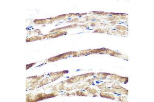 Immunohistochemistry of paraffin-embedded rat heart using Fbx32/FBOX32 Rabbit mAb (ABIN7267090) at dilution of 1:100 (40x lens). (FBXO32 antibody)