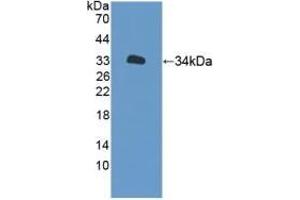 Detection of Recombinant XYLT2, Human using Polyclonal Antibody to Xylosyltransferase II (XYLT2) (XYLT2 antibody  (AA 596-865))