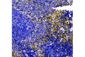 IHC analysis of ZEB2 using anti-ZEB2 antibody (ABIN3042325). (ZEB2 antibody  (AA 1-200))