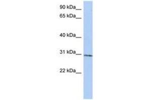 Image no. 1 for anti-tRNA Methyltransferase 61 Homolog A (TRMT61A) (N-Term) antibody (ABIN6743512) (TRMT61A antibody  (N-Term))