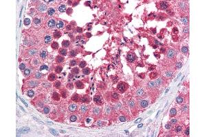 Anti-HSPA4L antibody IHC of human testis. (HSPA4L antibody  (AA 825-839))