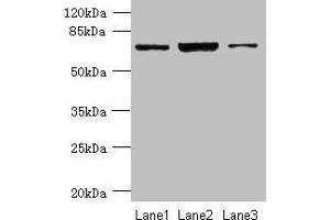 Western blot All lanes: CCDC116 antibody at 1. (CCDC116 antibody  (AA 1-300))