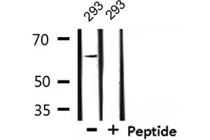 Western blot analysis of extracts from 293, using TGFR2 Antibody. (TGFBR2 antibody  (Internal Region))