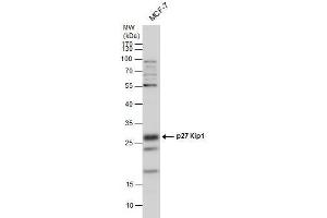 WB Image p27 Kip1 antibody detects p27 Kip1 protein by western blot analysis. (CDKN1B antibody)