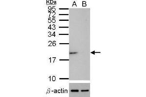 WB Image Western blot analysis of SOD1 (, upper panel) and beta-actin , lower panel)  Sample (30 ug of whole cell lysate)  A: HeLa mock control  B: HeLa transfected shSOD1 15% SDS PAGE  antibody diluted at 1:500 (SOD1 antibody  (C-Term))