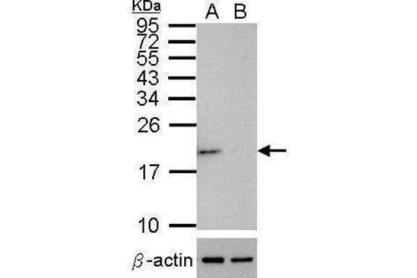SOD1 抗体  (C-Term)