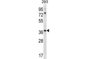 Western Blotting (WB) image for anti-Olfactory Receptor, Family 6, Subfamily X, Member 1 (OR6X1) antibody (ABIN2996693)