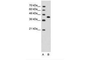 Image no. 2 for anti-Carcinoembryonic Antigen-Related Cell Adhesion Molecule 6 (CEACAM6) (AA 216-265) antibody (ABIN203400) (CEACAM6 antibody  (AA 216-265))