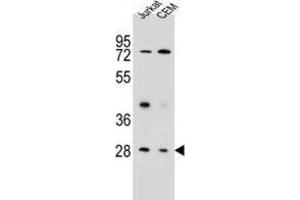 Western Blotting (WB) image for anti-Tetraspanin 26 (TSPAN26) antibody (ABIN2995796)
