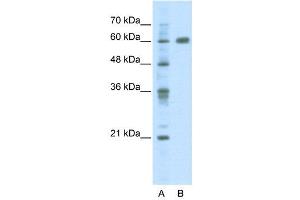 WB Suggested Anti-PDLIM5  Antibody Titration: 2. (PDLIM5 antibody  (C-Term))