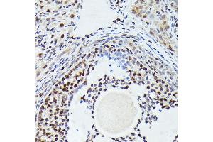 Immunohistochemistry of paraffin-embedded rat ovary using [KO Validated] CDK4 Rabbit mAb  at dilution of 1:100 (40x lens). (CDK4 antibody)