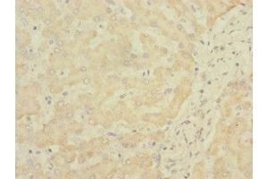 Immunohistochemistry of paraffin-embedded human liver tissue using ABIN7170777 at dilution of 1:100 (SOAT2 antibody  (AA 1-120))