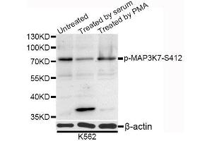 Western blot analysis of extracts of K-562 cells, using Phospho-MAP3K7-S412 antibody (ABIN5995645) at 1/1000 dilution. (MAP3K7 antibody  (pSer439))
