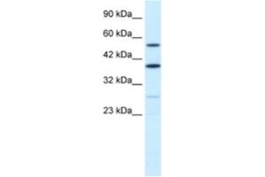 Western Blotting (WB) image for anti-A Kinase (PRKA) Anchor Protein 17A (AKAP17A) antibody (ABIN2460894)
