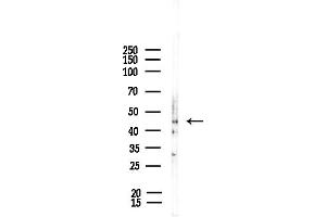 Western blot analysis of lysates from Rat liver, using 5H Receptor Antibody at 1/1000 dilution.