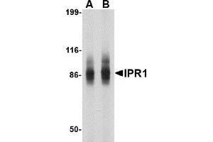 Western Blotting (WB) image for anti-SP110 Nuclear Body Protein (SP110) (N-Term) antibody (ABIN1031418) (SP110 antibody  (N-Term))