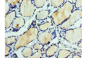 Immunohistochemistry of paraffin-embedded human thyroid tissue using ABIN7151875 at dilution of 1:100 (Ephrin A3 antibody  (AA 23-214))