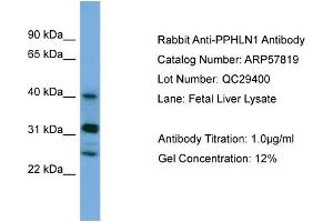 WB Suggested Anti-PPHLN1  Antibody Titration: 0. (PPHLN1 antibody  (N-Term))
