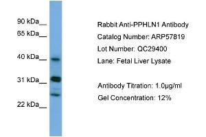 WB Suggested Anti-PPHLN1  Antibody Titration: 0.
