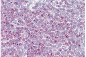 Anti-DLL1 antibody IHC staining of human spleen. (DLL1 antibody  (AA 640-700))