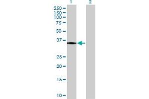 Western Blot analysis of HLA-DRA expression in transfected 293T cell line by HLA-DRA MaxPab polyclonal antibody. (HLA-DRA antibody  (AA 1-254))