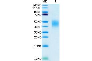 Human PD-L2 on Tris-Bis PAGE under reduced condition. (PDCD1LG2 Protein (His-Avi Tag))