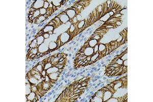 Immunohistochemistry of paraffin-embedded human colon using CLDN3 antibody (ABIN3017039, ABIN3017040, ABIN3017041, ABIN1679261 and ABIN6219930) (40x lens). (Claudin 3 antibody)