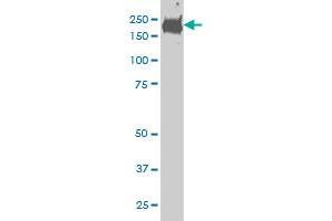 CDC42BPB monoclonal antibody (M02), clone 6G3 Western Blot analysis of CDC42BPB expression in HeLa . (CDC42BPB antibody  (AA 1580-1679))