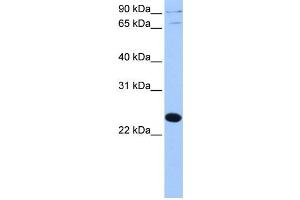 Western Blotting (WB) image for anti-Thyroid Hormone Receptor Associated Protein 3 Pseudogene 1 (THRAP3P1) antibody (ABIN2459455) (THRAP3P1 antibody)