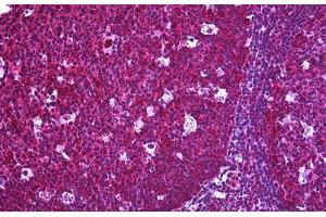 Human Tonsil: Formalin-Fixed, Paraffin-Embedded (FFPE) (FLIP antibody  (AA 178-277))