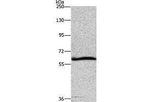 Western blot analysis of Hela cell, using DCP1A Polyclonal Antibody at dilution of 1:1100 (DCP1A antibody)