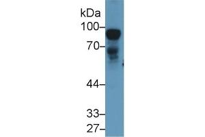 Detection of NEXN in Rat Testis lysate using Polyclonal Antibody to Nexilin (NEXN) (NEXN antibody  (AA 214-455))